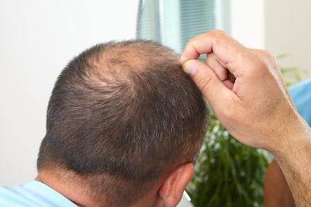 男生发质受损应该怎么修复